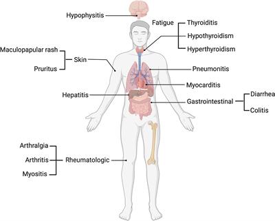Checkpoint inhibitor immune-related adverse events: A focused review on autoantibodies and B cells as biomarkers, advancements and future possibilities